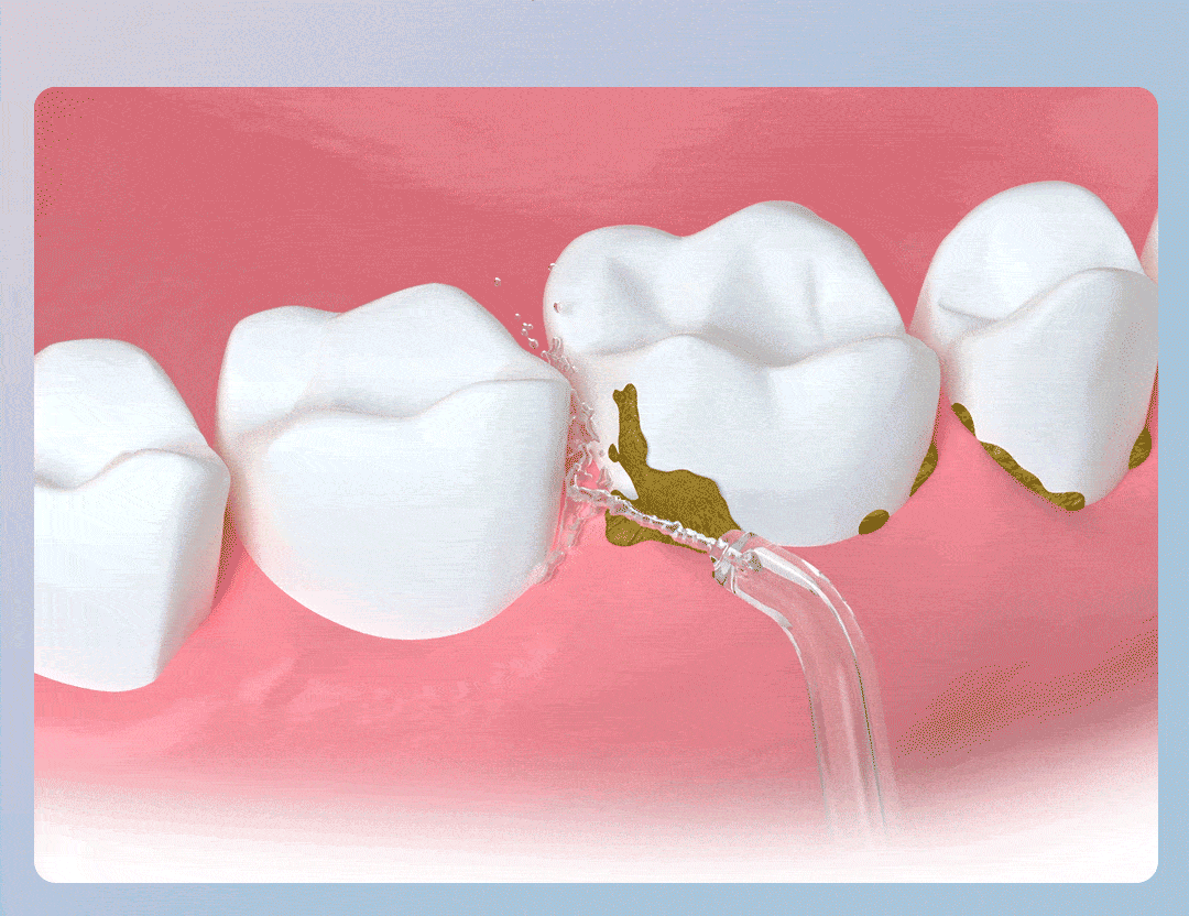 AquaSmile™ | Irrigador Bucal Recargable Limpieza Dental Profunda