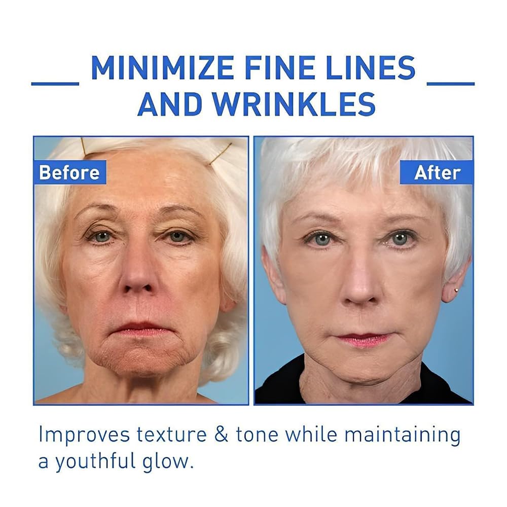 Botox Solution™ | Serum Antiarrugas Reafirmante Rejuvenecedor