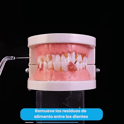 AquaSmile™ | Irrigador Bucal Recargable Limpieza Dental Profunda